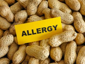 Shutterstock food allergies