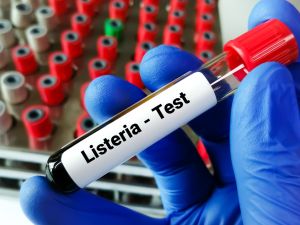 Shutterstock Listeria