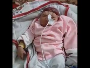 Video: Baby born without brain amid surge in birth defects in Gaza