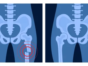 bone glue