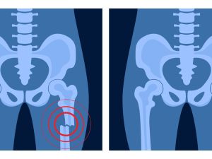 bone glue