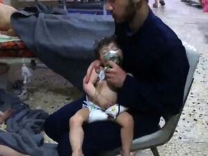 An unidentified volunteer holds an oxygen mask over a child's face at a hospital following an alleged chemical attack (AFP/File Photo)	