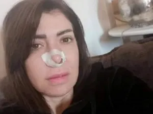 لقاء سويدان تخضع للجراجة: تجميل أم جيوب أنفية؟