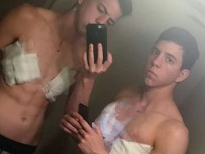 The twins, who have the same DNA, have grown facial hair since they began taking testosterone in April 2017 and underwent chest surgery in August 2018. Jack left, Jace right post surgery in August 2018 (dailymail)
