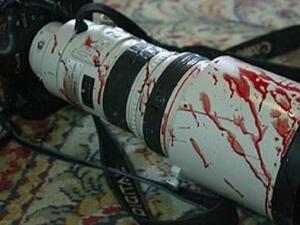 A camera's reporter in blood (AFP/File Photo)	