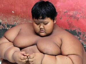 Arya Permana when weighing 31st 6lbs when he was just ten-years-old and had become Indonesia's fattest boy (dailymail)