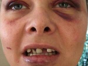 Lois Ashton (Twitter)