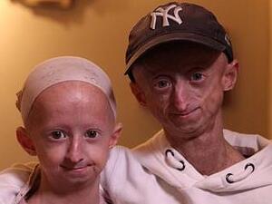 Michiel, 20, and Amber, 12, Vandeweert (Twitter)