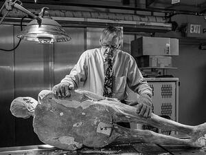 When Sue first volunteered herself, Dr Vic Spitzer said no, because of her various complications, including her hip replacement. Eventually he agreed, but it did mean some posthumous logistical acrobatics (Twitter)