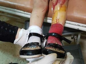 تسبَّبت تلك المجازر بحسب الشبكة باستشهاد 274 شخصاً، بينهم 117 طفلاً، و65 سيدة،