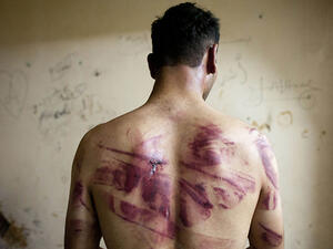 Syrian prisoner tortured by the Assad regime. (AFP/file) 