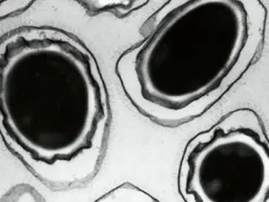 A microscopic view of anthrax spores. Photograph (AFP)