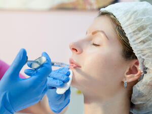 الفيلر في طب الأسنان التجميلي لتصحيح حجم الفم