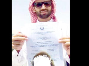 Last year, a jobless Saudi dentist filmed himself burning his dentistry certificate outside the Civil Service Ministry building in Hafr Al-Batin city because he could not find a job. (Twitter) Last year, a jobless Saudi dentist filmed himself burning his dentistry certificate outside the Civil Service Ministry building in Hafr Al-Batin city because he could not find a job. (Twitter)