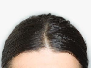 كل إنسان لديه قشرة الرأس بشكل أساسي