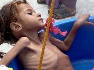 Time is running out for aid groups working in Yemen (Twitter)