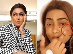 Waad was in a very bad psychological state after she discovered the results of a recent plastic surgery she had (Source: sana alsaid - Youtube - waedhanan - Instagram)