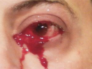 Man who cries blood (Twitter)