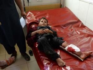 طفل أفغاني يعالج في المستشفى بعد التفجيرات في جلال اباد

