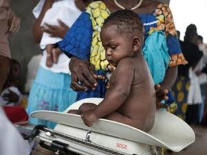 طفل على ميزان طبي في بوالي في جمهورية إفريقيا الوسطى
