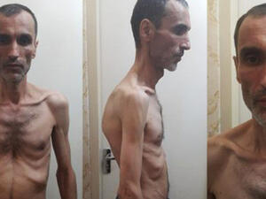 مساعد أحمدي نجاد المضرب عن الطعام ينشر صوراً مخيفة 