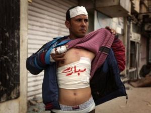 متظاهر مصاب/أ.ف.ب