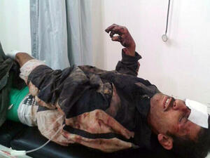 A wounded man is brought to a hospital in the eastern Lebanese city of Baalbek (AFP/STR)