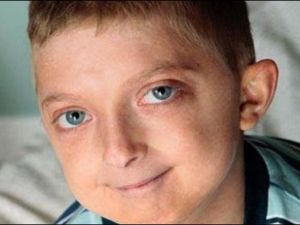 شيخوخة الأطفال 