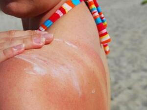 استعمال كريمات خالية من الزيوت يمنع الاصابة بالحروق والبثور المزعجة 