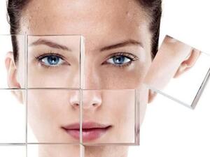 التخلص من الرؤوس السوداء ليس بالامر الصعب 