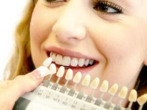 للحصول على درجة لونية أعلى يمكنك استشارة اخصائي تبييض الاسنان