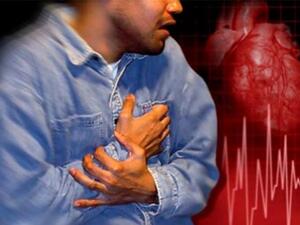 مرضى الصدفية يصبحون أكثر عرضة للإصابة بمخاطر أمراض القلب.