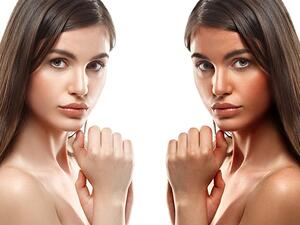 الان يمكنك عكس تأثير حروق الشمس بطرق طبيعية