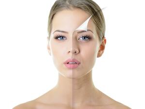 مصادر الكولاجين الطبيعية