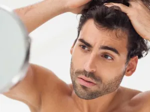 من منا لا يكره الصلع المبكر؟