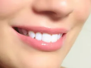 اسنان ناصعة البياض بطرق طبيعية