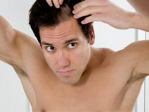 يجب استشارة الطبيب قبل البدء باستعمال اي علاج للصلع