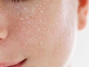 صورة توضيحية 