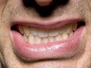 دليل مشاكل الاسنان التجميلة ‏‏
