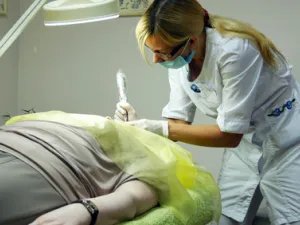 العلاج التبريدي يسمح بالقضاء على الخلايا الدهنية بطريقة طبيعية

