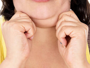 يمكن إخفاء دهون أي جزء من الجسم بارتداء الملابس باستثناء دهون الذقن