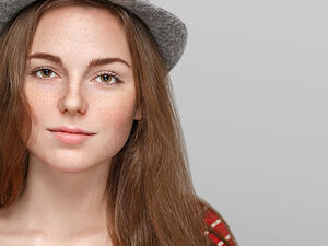 لا تخشي النمش فهو علامة جمال مميزة 