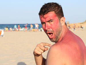 يخفف الخيار من حروق الشمس، والألم الناتج عنها، ويرطب الوجه أيضاً