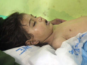 A girl in hospital in the northwestern Syrian, following a suspected toxic gas attack (AFP/File Photo)