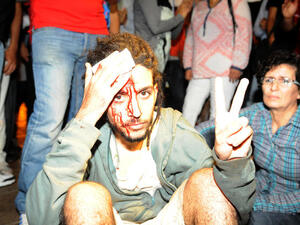 A protester injured during a demonstration on August 2, 2013 in Rabat-Morocco on the release of a Spanish pedophile (AFP/FADEL SENNA)