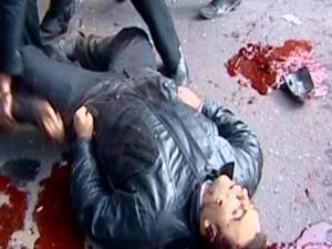 أحد ضحايا التفجيرات التي ضربت دمشق