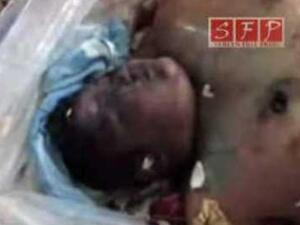 جثة الطفل حمزة الخطيب وقد بدا عليها آثار التعذيب
