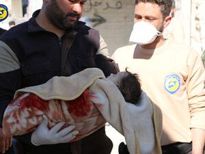 A picture reportedly showing one of the children killed in a "chemical" attack in Idlib, 4 April 2017. (Facebook/Idlib Civil Defence)