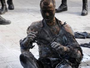 الشاب بعد احراق نفسه