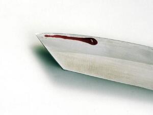 Knife with a drop of blood (AFP/File Photo)	